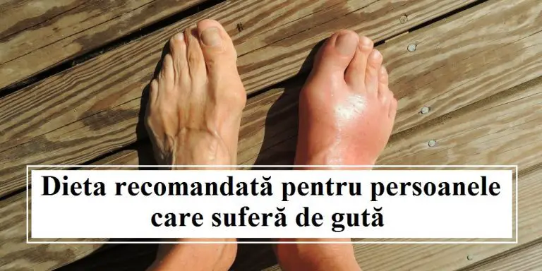 Regimul pentru pacientii cu guta