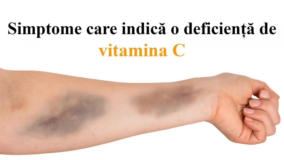 vitamina C